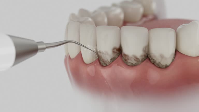 Trusted Teeth Cleaning And Checkup service in Frontenac, KS - Dentist Open Now